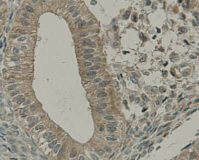 Immunohistochemistry-Paraffin: TMEM177 Antibody (A6-A11) [NBP2-67213] - Analysis of paraffin-embedded human uterus muscle tissue using anti-TMEM177 antibody. Counter stained with hematoxylin.