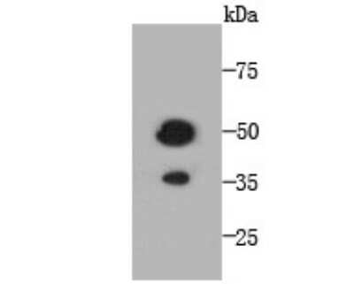 Western Blot: TMEM177 Antibody (A6-A11) [NBP2-67213] - Analysis of TMEM177 on recombinant protein using anti-TMEM177 antibody at 1/1,000 dilution.