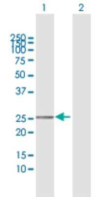 Western Blot: TMEM177 Antibody [H00080775-D01P] - Analysis of TMEM177 expression in transfected 293T cell line by TMEM177 polyclonal antibody.Lane 1: TMEM177 transfected lysate(31.02 KDa).Lane 2: Non-transfected lysate.