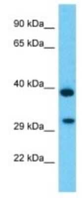 Western Blot: TMEM177 Antibody [NBP3-09896] - Western blot analysis of TMEM177 in COLO205 Whole Cell lysates. Antibody dilution at 1.0ug/ml