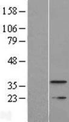 Western Blot: TMEM177 Overexpression Lysate (Adult Normal) [NBP2-09354] Left-Empty vector transfected control cell lysate (HEK293 cell lysate); Right -Over-expression Lysate for TMEM177.