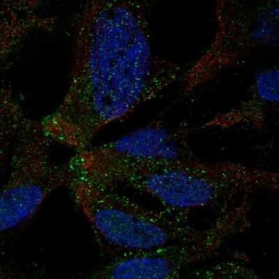 Immunocytochemistry/Immunofluorescence: TMEM178 Antibody [NBP2-13447] - Staining of human cell line AF22 shows localization to nucleus & vesicles. Antibody stainng is shown in green.