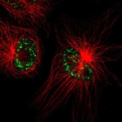 Immunocytochemistry/Immunofluorescence: TMEM179B Antibody [NBP1-86062] - Staining of human cell line U-251 MG shows positivity in nucleus but excluded from the nucleoli. Antibody staining is shown in green.