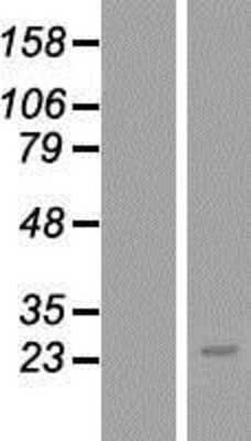 Western Blot: TMEM179B Overexpression Lysate (Adult Normal) [NBL1-17045] Left-Empty vector transfected control cell lysate (HEK293 cell lysate); Right -Over-expression Lysate for TMEM179B.