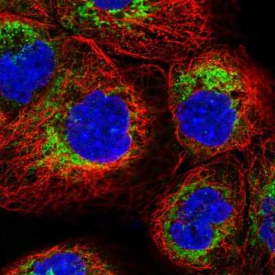 Immunocytochemistry/Immunofluorescence: TMEM18 Antibody [NBP1-90558] - Immunofluorescent staining of human cell line A-431 shows localization to mitochondria.