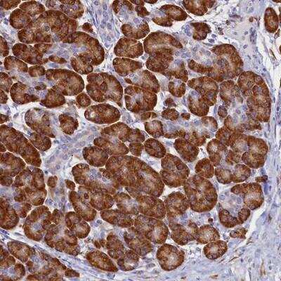 Immunohistochemistry: TMEM18 Antibody [NBP1-90558] - Staining of human pancreas shows strong cytoplasmic positivity in exocrine pancreas.