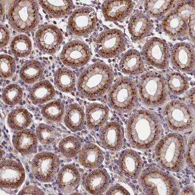 Immunohistochemistry-Paraffin: TMEM181 Antibody [NBP1-93711] - Staining of human stomach shows strong cytoplasmic positivity, with a granular pattern in glandular cells.