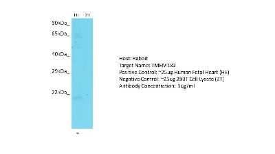 Western Blot: TMEM182 Antibody [NBP2-83681] - Host: Rabbit. Target: TMEM182. Positive control (+): Human Fetal Heart (HE). Negative control (-): 293T Cell Lysate (2T). Antibody concentration: 1ug/ml