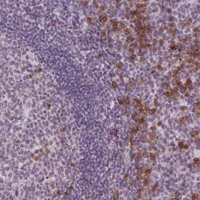 Immunohistochemistry TMEM184A Antibody - BSA Free