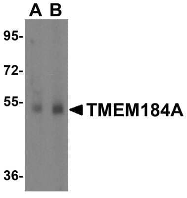 Western Blot: TMEM184A Antibody [NBP1-77142] - Analysis of TMEM184A in rat brain tissue lysate with TMEM184A antibody at 1 ug/mL in (A) the absence and (B) the presence of blocking peptide.