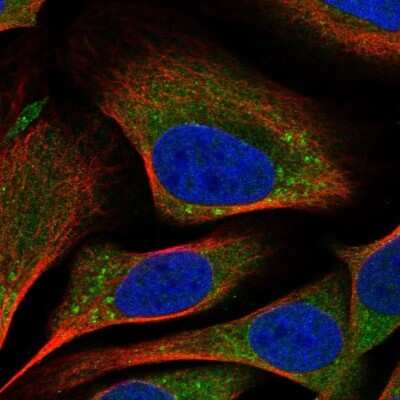 Immunocytochemistry/Immunofluorescence: TMEM184B Antibody [NBP1-86810] - Immunofluorescent staining of human cell line U-2 OS shows localization to cytosol & the Golgi apparatus.