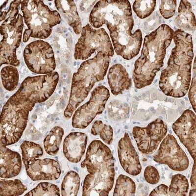 Immunohistochemistry-Paraffin: TMEM184B Antibody [NBP1-86810] - Staining of human kidney shows strong cytoplasmic positivity in cells of tubules.