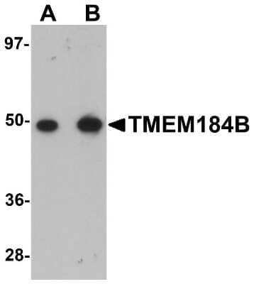 Western Blot TMEM184B Antibody - BSA Free