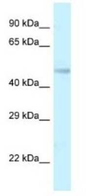 Western Blot TMEM184B Antibody - BSA Free