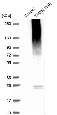 Western Blot TMEM184B Antibody - BSA Free