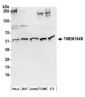 Western Blot: TMEM184B Antibody [NBP2-37756] - Detection of Human and Mouse TMEM184B by Western Blot. Samples: Whole cell lysate (50 ug) from HeLa, 293T, Jurkat, mouse TCMK-1, and mouse NIH3T3 cells prepared using NETN lysis buffer. Antibodies: Affinity purified rabbit anti-TMEM184B antibody used for WB at 0.4 ug/ml. Detection: Chemiluminescence with an exposure time of 30 seconds.