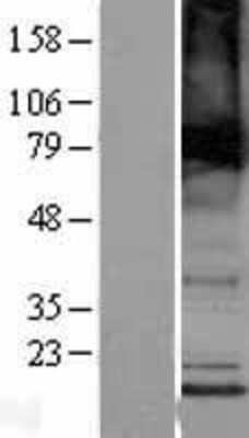 Western Blot: TMEM184B Overexpression Lysate (Adult Normal) [NBP2-04333] Left-Empty vector transfected control cell lysate (HEK293 cell lysate); Right -Over-expression Lysate for TMEM184B.