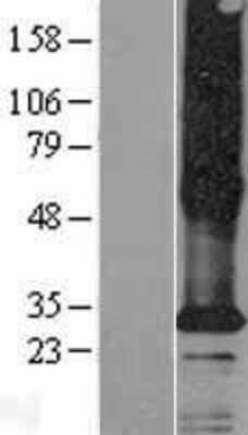 Western Blot: TMEM185A Overexpression Lysate (Adult Normal) [NBP2-06013] Left-Empty vector transfected control cell lysate (HEK293 cell lysate); Right -Over-expression Lysate for TMEM185A.
