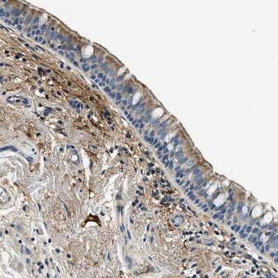 Immunohistochemistry-Paraffin: TMEM186 Antibody [NBP1-88452] - Staining of human bronchus shows moderate cytoplasmic and membranous positivity in respiratory epithelial cells.