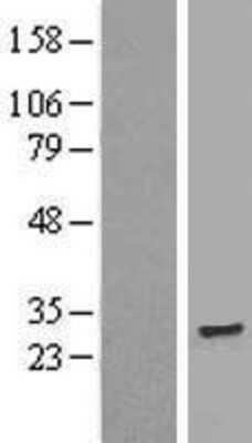 Western Blot: TMEM186 Overexpression Lysate (Adult Normal) [NBL1-17049] Left-Empty vector transfected control cell lysate (HEK293 cell lysate); Right -Over-expression Lysate for TMEM186.