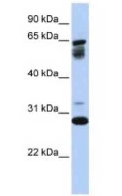 Western Blot: TMEM187 Antibody [NBP1-69553] - Antibody  Titration: 0.2-1 ug/ml ELISA Titer: 1 : 312500 Positive control: 721_B cell lysate TMEM187 is supported by BioGPS gene expression data to be expressed in 721_B.