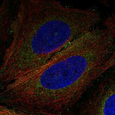 Immunocytochemistry/Immunofluorescence: TMEM188 Antibody [NBP2-58839] - Staining of human cell line U-2 OS shows localization to cytosol.