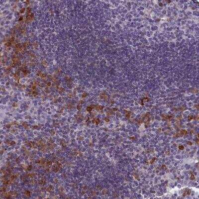 Immunohistochemistry-Paraffin TMEM188 Antibody