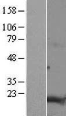 Western Blot: TMEM188 Overexpression Lysate (Adult Normal) [NBL1-17050] Left-Empty vector transfected control cell lysate (HEK293 cell lysate); Right -Over-expression Lysate for TMEM188.