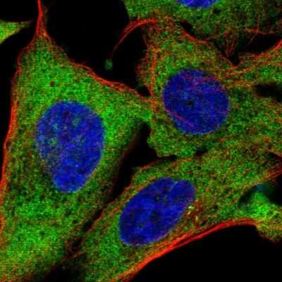 Immunocytochemistry/Immunofluorescence: TMEM189 Antibody [NBP2-32476] - Staining of human cell line U-2 OS shows localization to endoplasmic reticulum. Antibody staining is shown in green.