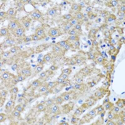 Immunohistochemistry-Paraffin: TMEM189 Antibody [NBP2-94610] - Human liver using TMEM189 antibody at dilution of 1:100 (40x lens).Perform microwave antigen retrieval with 10 mM PBS buffer pH 7.2 before commencing with IHC staining protocol.