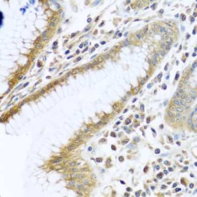Immunohistochemistry-Paraffin: TMEM189 Antibody [NBP2-94610] - Human stomach using TMEM189 antibody at dilution of 1:100 (40x lens).Perform microwave antigen retrieval with 10 mM PBS buffer pH 7.2 before commencing with IHC staining protocol.