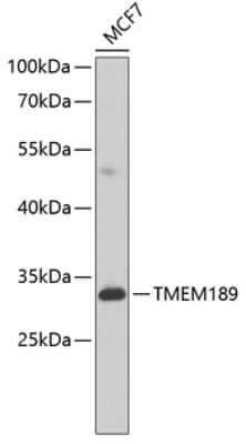 Western Blot: TMEM189 Antibody [NBP2-94610] - Analysis of extracts of MCF-7 cells, using TMEM189 at 1:1000 dilution.Secondary antibody: HRP Goat Anti-Rabbit IgG (H+L) at 1:10000 dilution.Lysates/proteins: 25ug per lane.Blocking buffer: 3% nonfat dry milk in TBST.Detection: ECL Basic Kit .Exposure tim