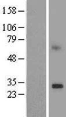 Western Blot: TMEM189 Overexpression Lysate (Adult Normal) [NBL1-17051] Left-Empty vector transfected control cell lysate (HEK293 cell lysate); Right -Over-expression Lysate for TMEM189.