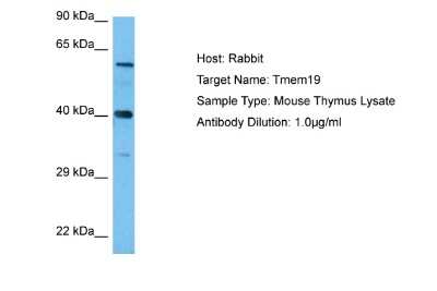 Western Blot: TMEM19 Antibody [NBP2-83682] - Host: Rabbit. Target Name: TMEM19. Sample Tissue: Mouse Thymus lysates. Antibody Dilution: 1ug/ml