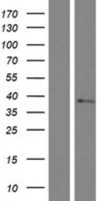 Western Blot: TMEM19 Overexpression Lysate (Adult Normal) [NBP2-06829] Left-Empty vector transfected control cell lysate (HEK293 cell lysate); Right -Over-expression Lysate for TMEM19.