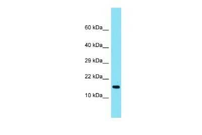 Western Blot: TMEM190 Antibody [NBP3-09652] - Western blot analysis of TMEM190 in Fetal Heart lysates. Antibody dilution at 1.0ug/ml