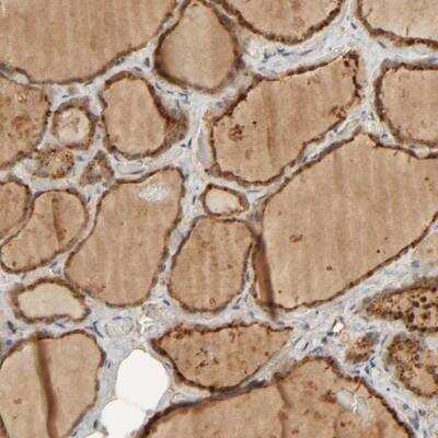 Immunohistochemistry: TMEM192 Antibody [NBP1-93799] - Staining of human thyroid gland shows strong cytoplasmic positivity in glandular cells.