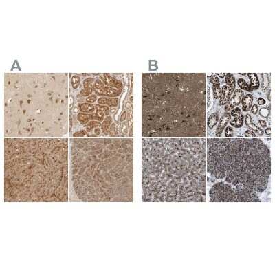 <b>Independent Antibodies Validation. </b>Immunohistochemistry-Paraffin: TMEM192 Antibody [NBP1-93799] - Staining of human cerebral cortex, kidney, liver and pancreas using Anti-TMEM192 antibody NBP1-93799 (A) shows similar protein distribution across tissues to independent antibody NBP1-93798 (B).