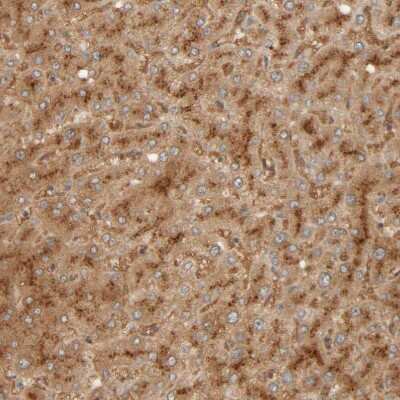 Immunohistochemistry-Paraffin: TMEM192 Antibody [NBP1-93799] - Staining of human liver shows moderate to strong granular cytoplasmic positivity in hepatocytes.