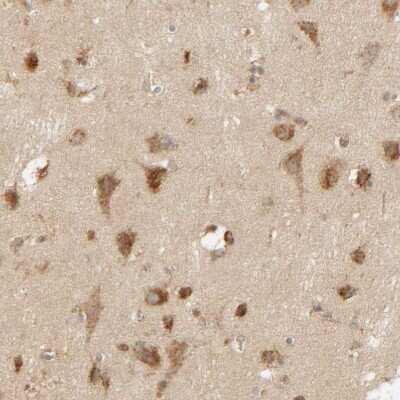 Immunohistochemistry-Paraffin: TMEM192 Antibody [NBP1-93799] - Staining of human cerebral cortex shows moderate to strong granular cytoplasmic positivity in neurons.