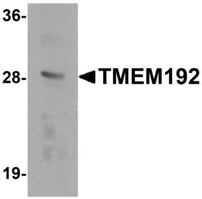 Western Blot: TMEM192 Antibody [NBP2-82029] - Analysis of TMEM192 in SK-N-SH cell lysate with TMEM192 antibody at 0.5 ug/ml.