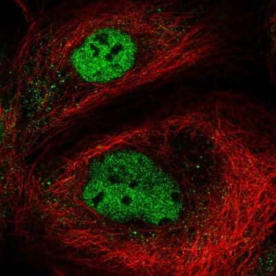 Immunocytochemistry/ Immunofluorescence TMEM194B Antibody - BSA Free