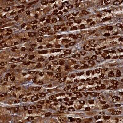 Immunohistochemistry-Paraffin: TMEM196 Antibody [NBP1-93472] - Staining of human stomach, lower shows strong cytoplasmic positivity in parietal cells.