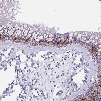 Immunohistochemistry-Paraffin: TMEM198 Antibody [NBP2-34164] - Staining of human nasopharynx shows strong nuclear positivity in respiratory epithelial cells.