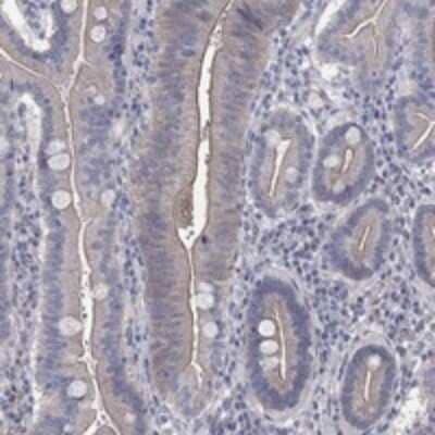 Immunohistochemistry-Paraffin TMEM198 Antibody - BSA Free