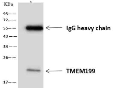 Immunoprecipitation: TMEM199 Antibody [NBP3-06494] - Lane A:0.5 mg U 251 MG Whole Cell Lysate4 uL anti-TMEM199 rabbit polyclonal antibody and 60 ug of Immunomagnetic beads Protein A/G.Primary antibody:Anti-TMEM199 rabbit polyclonal antibody,at 1:100 dilution Secondary antibody:Goat Anti-Rabbit IgG (H+L)/HRP at 1/10000 dilutionDeveloped using the ECL technique.Performed under reducing conditions.Predicted band size: 23 kDaObserved band size :23 kDa