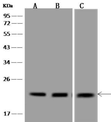 Western Blot: TMEM199 Antibody [NBP3-06494] - Lane A: A549 Whole Cell LysateLane B: 293 Whole Cell LysateLane C: U 251 MG Whole Cell LysateLysates/proteins at 30 ug per lane.SecondaryGoat Anti-Rabbit IgG (H+L)/HRP at 1/10000 dilution.Developed using the ECL technique.Performed under reducing conditions.Predicted band size:23 kDaObserved band size:23 kDa
