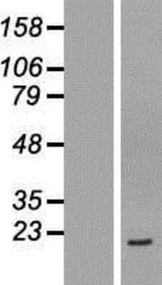 Western Blot: TMEM199 Overexpression Lysate (Adult Normal) [NBL1-17055] Left-Empty vector transfected control cell lysate (HEK293 cell lysate); Right -Over-expression Lysate for TMEM199.