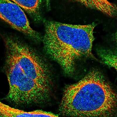 Immunocytochemistry/ Immunofluorescence TMEM2 Antibody