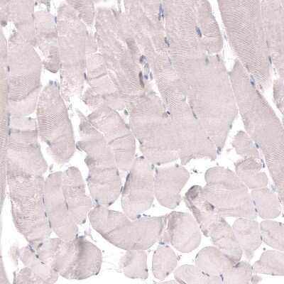 Immunohistochemistry-Paraffin TMEM2 Antibody